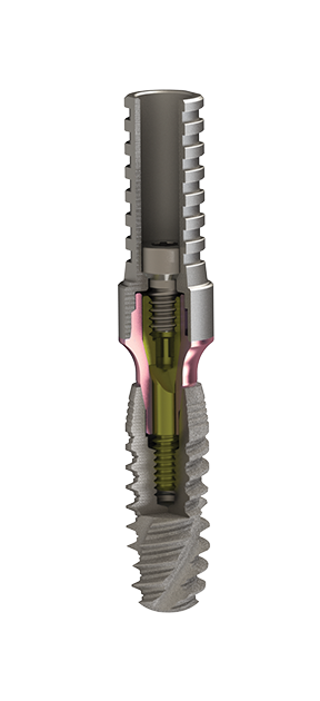 pmc3_Implants_Conical_Connection_Tissue_Care pmc3_Implants_Conical_Connection_Tissue_Care